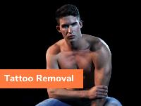 The Tattoo Removal Experts image 11